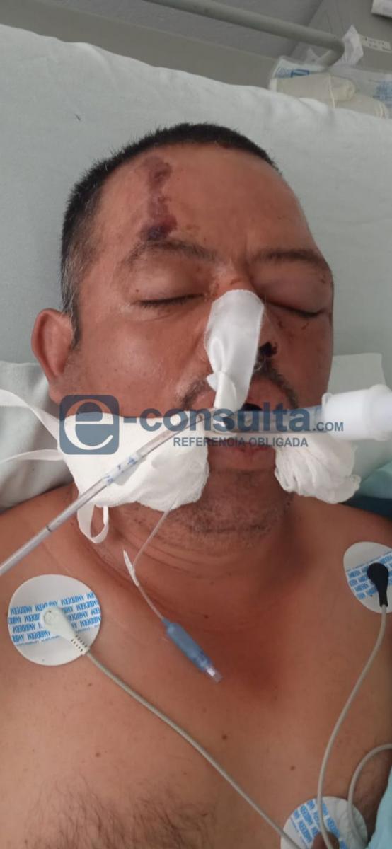 Foto: Braulio Sánchez hospitalizado en IMSS Zacapoaxtla | Cortesía