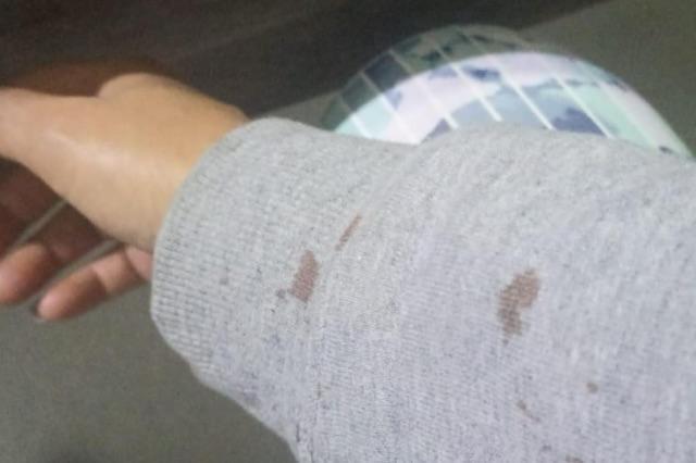 Mujer violentada durante un asalto en Tonantzintla