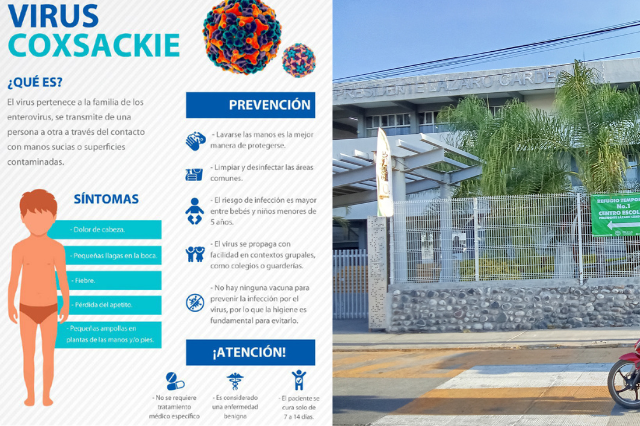 Coxsackie en Izúcar de Matamoroa