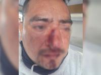 Golpean y asaltan a chofer particular en Tecamachalco