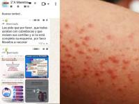 Alerta por sarampión en San Martín